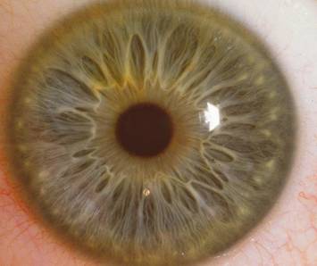 Iris Scanning