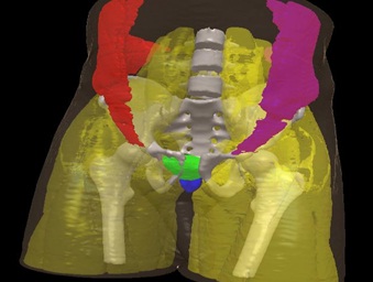 3D-DOCTOR and models created