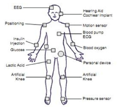 Wireless Body Area Network