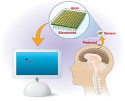 Brain Gate